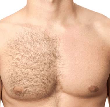 Chest waxing deals