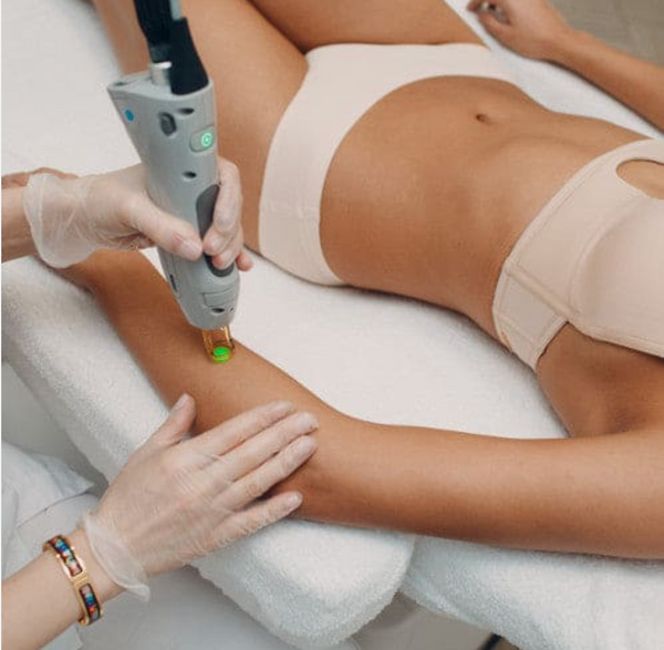 Underarm Laser Hair Removal