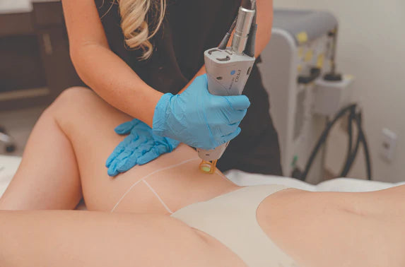 Brazilian Laser