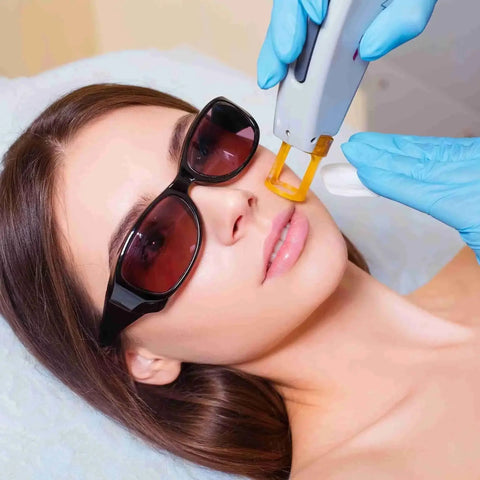 Chin Laser