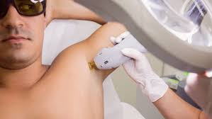 Underarm Laser for Him